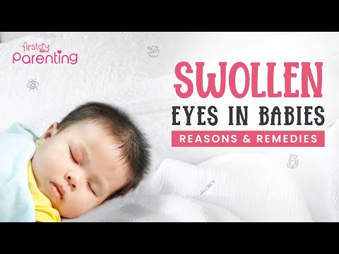 Swollen Eyes in Babies - Causes and Remedies