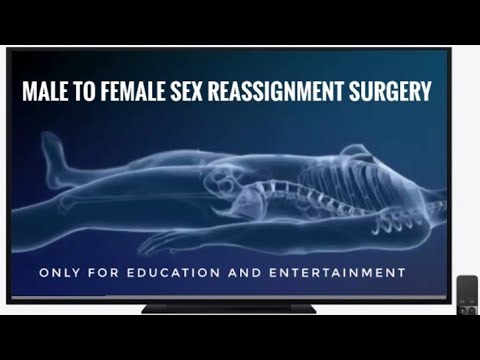 Male to Female surgical transformation