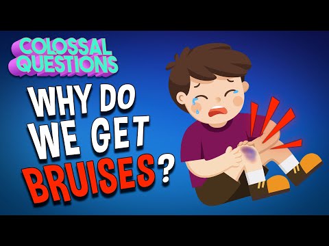 Why Do We Get Bruises? | COLOSSAL QUESTIONS