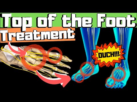 TOP of the FOOT PAIN Home Treatment [Exercises, Massage, Stretches]