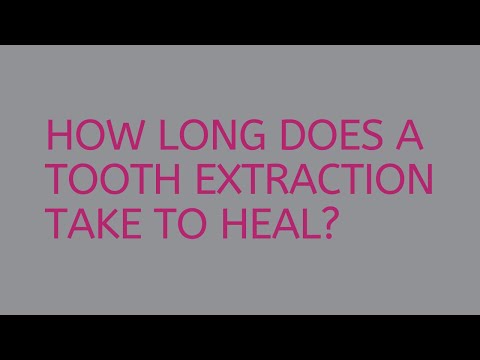 How long does a tooth extraction take to heal? | Angela Cowell