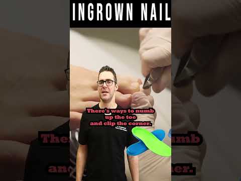 Ingrown Toenail Self Care & Home Treatment